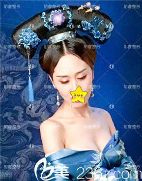 整形医院卢刚假体丰胸真人案例：从A－到C＋，暴增回头率