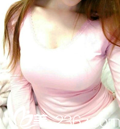 我找太原欧美莲张世民做隆胸术后一个月的效果 我找太原欧美莲张世民做隆胸术后一个月的效果