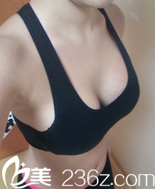 医生哪个尺子和笔在我胸部画线 医生哪个尺子和笔在我胸部画线