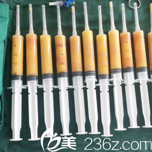 余恩旭医生从我腿部抽出的脂肪 余恩旭医生从我腿部抽出的脂肪