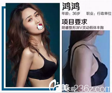 假体丰胸前后对比