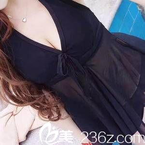 辣妈逆袭记 自体脂肪丰胸让她成为挺翘佳人