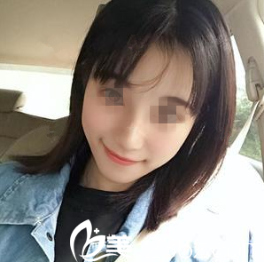 在南宁韩成做鼻综合手术后10天 在南宁韩成做鼻综合手术后10天