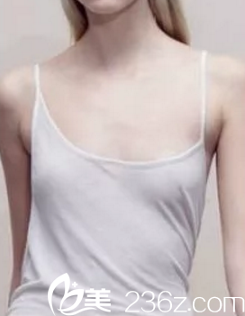 手术前的我 手术前的我