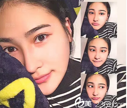 <!--<i data=20240703-sp></i>-->整形医院做鼻子怎么样