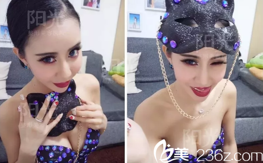 <!--<i data=20240703-sp></i>-->李映雨隆胸案例 <!--<i data=20240703-sp></i>-->李映雨隆胸案例