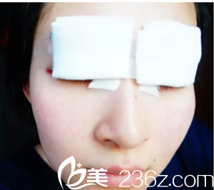 刚做完手术还贴着纱布的照片 刚做完手术还贴着纱布的照片