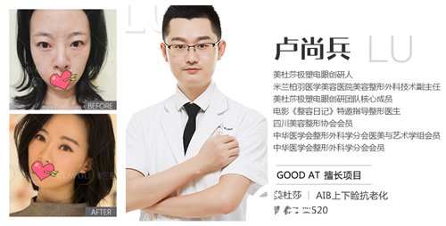 米兰柏羽卢尚兵美杜莎双眼皮案例 米兰柏羽卢尚兵美杜莎双眼皮案例