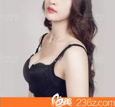 宁波薇琳娜绮丽假体隆胸<span style=