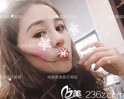 膨体隆鼻术后7天拆线后效果 膨体隆鼻术后7天拆线后效果