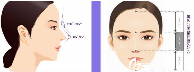 南宁芭芘丽鼻综合手术