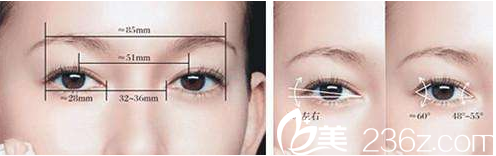 南宁芭芘丽眼综合手术