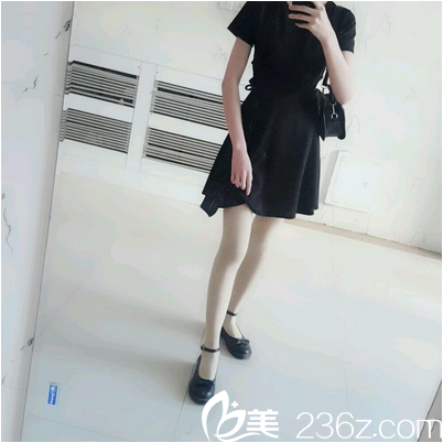 广州美莱张毓吸脂怎么样 广州美莱张毓吸脂怎么样