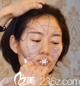 我术前时候 我术前时候