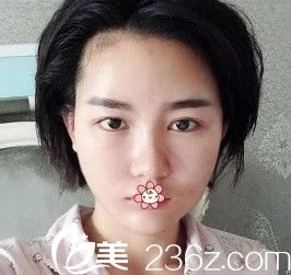 手术当天 手术当天