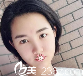 黄皓医生给我做完手术第五天 黄皓医生给我做完手术第五天