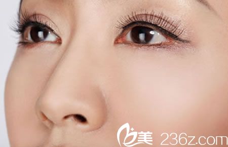 宁波米阳整形医院做双眼皮多少钱?曹英武院长主刀双眼皮手术价格2000元你说贵不贵