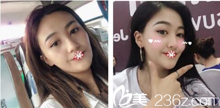 杨东运院长给我手术后第十天 杨东运院长给我手术后第十天