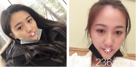 21天的样子我已经很喜欢了 21天的样子我已经很喜欢了