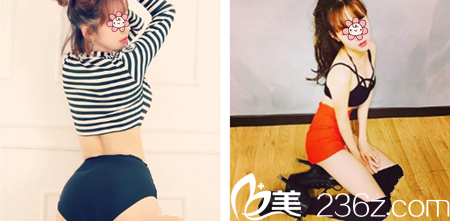 重庆好美整形吸脂怎么样