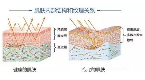 面部皱纹不知道怎么改善？长春张曼2019年整形优惠热玛吉仅需6400元