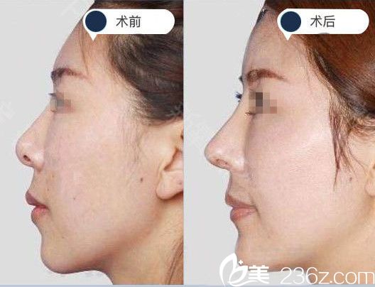 医学美容排名_医学美容(2)