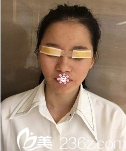 王靖院长给我做手术当天 王靖院长给我做手术当天