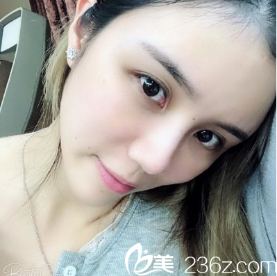 广州哪家医院做脂肪填充好 广州哪家医院做脂肪填充好