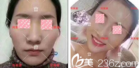 遵义利美康怎么样 遵义利美康怎么样