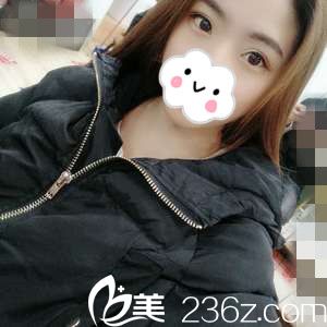 只是在株洲华美年华做了个切开双眼皮+开内眼角，没想到就发生了这么大的变化