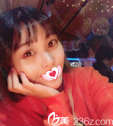 术后一个月效果 术后一个月效果