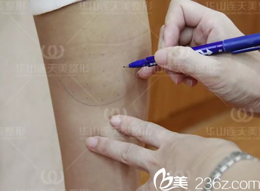 用笔画出注射瘦腿的注射点 用笔画出注射瘦腿的注射点