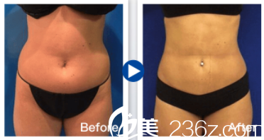 中国台湾京媛体型雕塑案例 中国台湾京媛体型雕塑案例