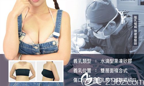中国台湾陈建璋医师隆胸案例 中国台湾陈建璋医师隆胸案例