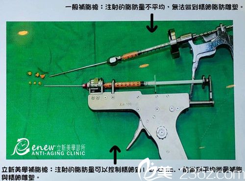 中国台湾立新美学诊所脂肪枪示意图