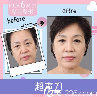 汕头华美田学勤治疗案例