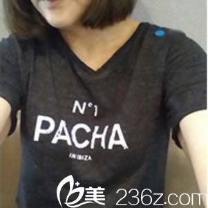 在绍兴一美做隆胸手术前 在绍兴一美做隆胸手术前