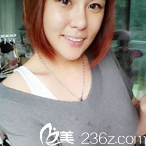 做完假体和脂肪隆胸8天恢复照 做完假体和脂肪隆胸8天恢复照