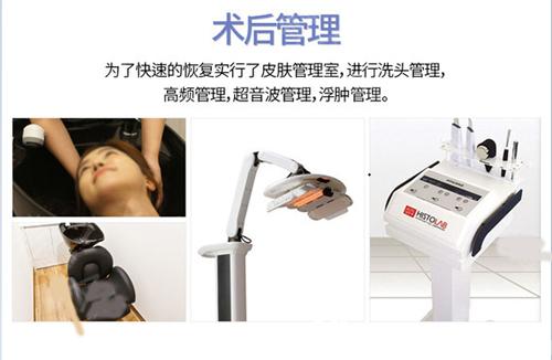 韩国秀梦整形颧骨手术术后管理 韩国秀梦整形颧骨手术术后管理