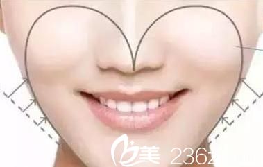 易韩安和美容整形医院会告诉你什么是心形脸 易韩安和美容整形医院会告诉你什么是心形脸