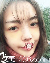 尹贤哲院长给我手术后第三天 尹贤哲院长给我手术后第三天