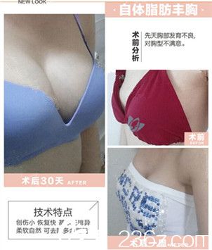 美立方自体脂肪隆胸变化图 美立方自体脂肪隆胸变化图