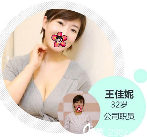 湖州尚丽胡承林假体隆胸案例 湖州尚丽胡承林假体隆胸案例