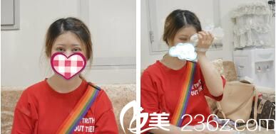 切开双眼皮术后即刻冰敷消肿 切开双眼皮术后即刻冰敷消肿