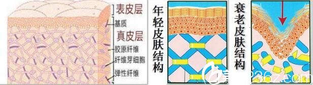 李雄艳讲线雕提升原理 李雄艳讲线雕提升原理