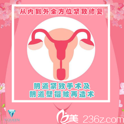 阴道紧致手术及阴道壁褶皱再造术 阴道紧致手术及阴道壁褶皱再造术