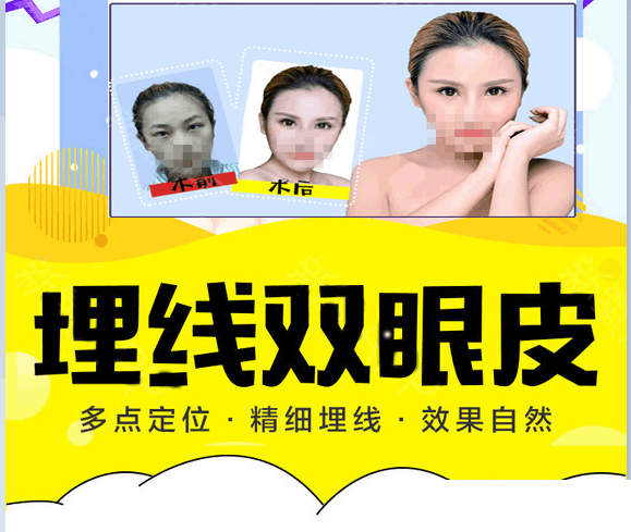 南昌鹏爱整形私人定制专属美眼，效果自然，精细埋线，在线预约价880元