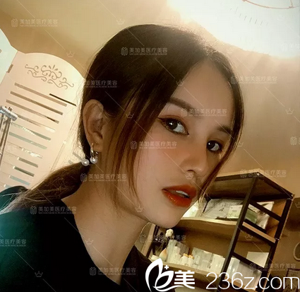 深圳美加美隆鼻案例
