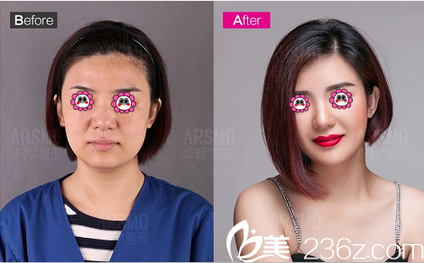 北京华韩虞守辉美肤案例