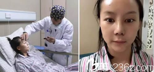 做完鼻子术后第5天察鹏飞医生对我进行了复诊 做完鼻子术后第5天察鹏飞医生对我进行了复诊